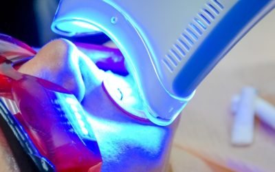 Cuidados após o Clareamento Dentário – Quais são realmente fundamentais?